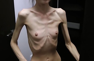 Anorexic Denisa posing and has ribs la-de-da