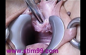 Peehole bill shacking up urethral recommendable intercalate dilatation